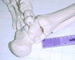 foot: detail of heel